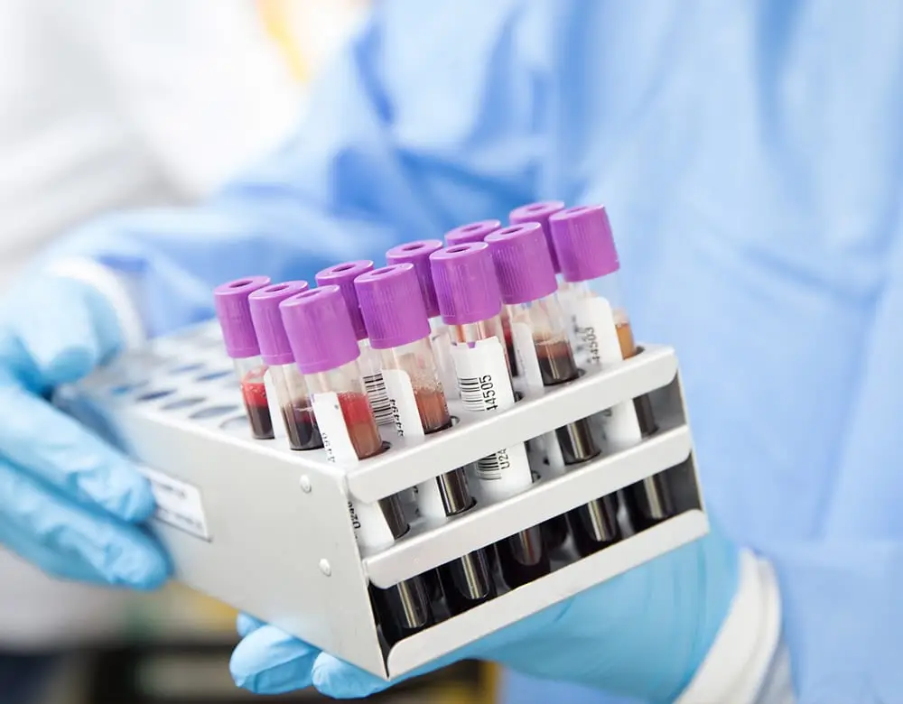 Lab and blood testing services at home in Dubai with accurate and quick results