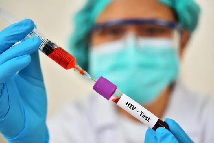 HIV TEST IN DUBAI AT HOME LAB