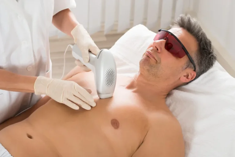 DUBAI Laser hair removal at home service