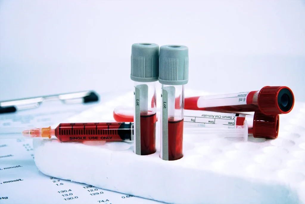 DUBAI at Home Blood Test Service
