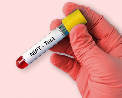 Home NIPT genetic test kit in Dubai for prenatal screening