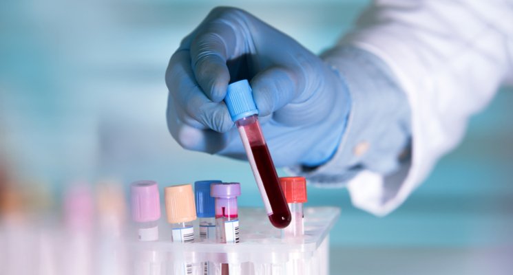 At Home Pancreatic Blood Test DUBAI